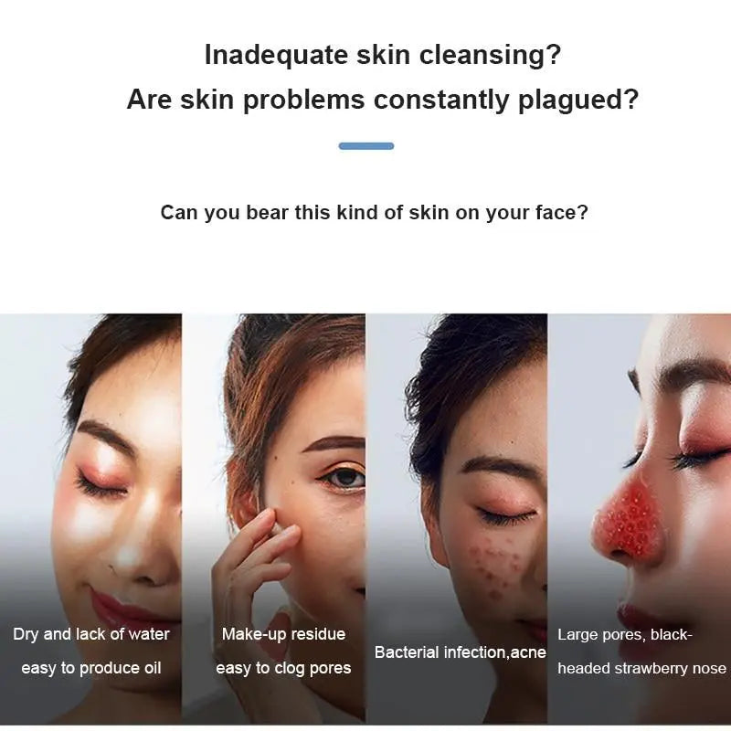 Electric blackhead vacuum remover from Health & Beauty-5 with a sleek design and multiple suction heads for facial pore cleansing.