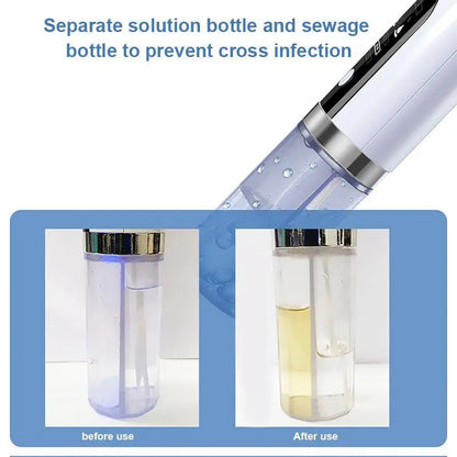 Electric blackhead vacuum remover by Health & Beauty-5 showing the device with suction nozzle on a clean skin surface