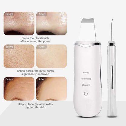 Deep facial cleanser and face scrubber from Health & Beauty-5, featuring a sleek blue bottle and exfoliating brush attachment.