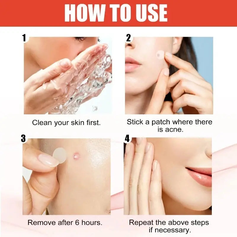 Mighty Patch Original Acne Patch,Hydrocolloid Acne Pimple Patches for Face,Nighttime Spot Pimple Stickers for Face Skin in 1 Use Zenn Organics Inc