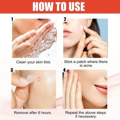Mighty Patch Original Acne Patch,Hydrocolloid Acne Pimple Patches for Face,Nighttime Spot Pimple Stickers for Face Skin in 1 Use Zenn Organics Inc